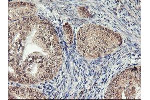 Image no. 2 for anti-1-Acylglycerol-3-Phosphate O-Acyltransferase 5 (Lysophosphatidic Acid Acyltransferase, Epsilon) (AGPAT5) antibody (ABIN1496498) (AGPAT5 antibody)