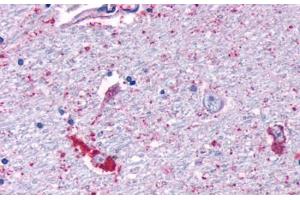 Anti-MRGPRF antibody  ABIN1049073 IHC staining of human brain, neurons and glia.