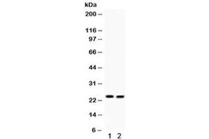 Western blot testing of 1) mouse lung and 2) mouse intestine lysate with LCN2 antibody. (Lipocalin 2 antibody  (AA 21-198))
