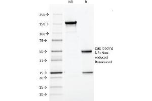 SDS-PAGE Analysis Purified HPV-16 Monoclonal Antibody (CAMVIR-1). (HPV16 antibody)