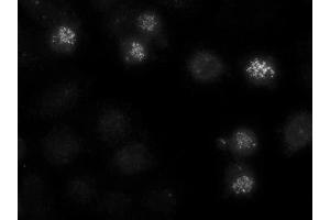 Image no. 1 for anti-Centromere Protein E, 312kDa (CENPE) antibody (ABIN108563) (CENPE antibody)