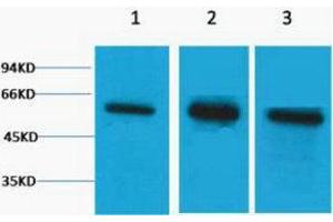 Western Blotting (WB) image for anti-Tubulin, beta (TUBB) antibody (ABIN3178782) (TUBB antibody)