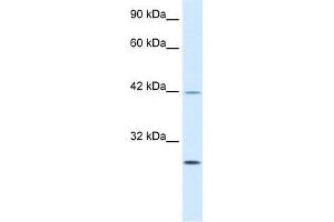 Human Jurkat; WB Suggested Anti-KLF9 Antibody Titration: 0. (KLF9 antibody  (N-Term))