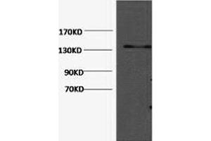 Western Blotting (WB) image for anti-Collagen, Type III, alpha 1 (COL3A1) antibody (ABIN5959045) (COL3A1 antibody)