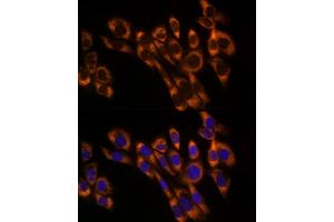 Immunofluorescence analysis of NIH/3T3 cells using PREB Rabbit mAb (ABIN7269547) at dilution of 1:50 (40x lens). (PREB antibody)