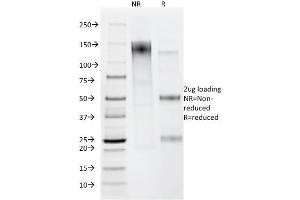 SDS-PAGE Analysis Purified Helicobacter pylori Mouse Monoclonal Antibody (HP/212). (Helicobacter Pylori antibody)