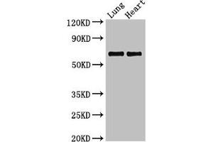 Western Blot Positive WB detected in: Rat lung tissue, Rat heart tissue All lanes: POLL antibody at 2.