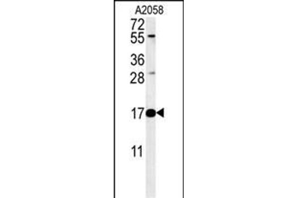 Ribonuclease K antibody  (AA 26-55)