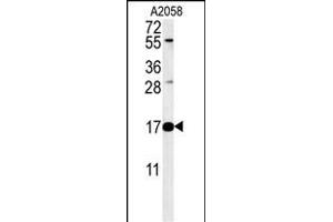RNASEK Antibody (Center) &65288,Cat(ABIN651452 and ABIN2840246)&65289, western blot analysis in  cell line lysates (35 μg/lane). (Ribonuclease K antibody  (AA 26-55))