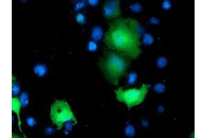 Anti-TOMM34 mouse monoclonal antibody (ABIN2454784) immunofluorescent staining of COS7 cells transiently transfected by pCMV6-ENTRY TOMM34 (RC201083). (TOMM34 antibody)