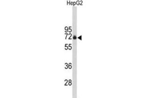 Western Blotting (WB) image for anti-F-Box Protein 3 (FBXO3) antibody (ABIN3004076)