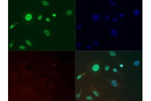 Immunofluorescence of Anti-Histone H3 K36 me3: Histone H3 Me3 Lys36 antibody was tested at 1:500 in HeLa cells with FITC (green). (Histone 3 antibody  (H3K36me3))