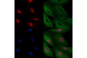 ABIN6259555 and ABIN6275395 staining  cells by IF/ICC. (SLU7 antibody  (Internal Region))