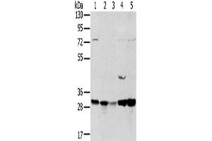Western Blotting (WB) image for anti-Tumor Protein D52-Like 2 (TPD52L2) antibody (ABIN2434039) (TPD52L2 antibody)