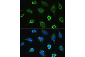 Immunofluorescence analysis of L929 cells using LARS Rabbit pAb (ABIN7268238) at dilution of 1:100. (LARS antibody  (AA 1-270))