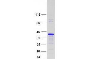 Western Blotting (WB) image for Vestigial Like 4 (VGLL4) (Transcript Variant 2) protein (Myc-DYKDDDDK Tag) (ABIN2735252)
