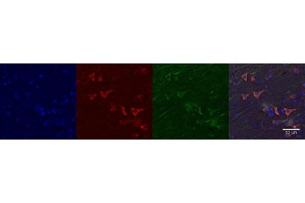 ACCN4 antibody