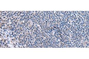 Immunohistochemistry of paraffin-embedded Human tonsil tissue using CCK Polyclonal Antibody at dilution of 1:55. (Cholecystokinin antibody)