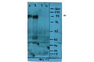 Western Blot analysis using CD107a / LAMP1 Antibody Cat. (LAMP1 antibody)