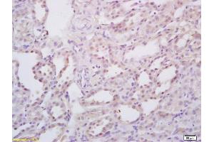 Formalin-fixed and paraffin embedded rat kidney labeled with Rabbit Anti StAR/StARD1 Polyclonal Antibody, Unconjugated (ABIN700960) at 1:200 followed by conjugation to the secondary antibody and DAB staining (STAR antibody  (AA 101-200))