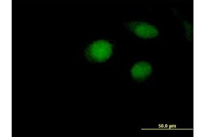 Immunofluorescence of purified MaxPab antibody to ARL4A on HeLa cell. (ARL4A antibody  (AA 1-200))