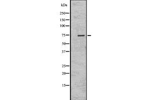 Western blot analysis of KIFC1 using K562 whole cell lysates (KIFC1 antibody  (Internal Region))