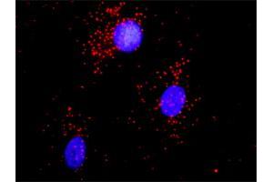 Proximity Ligation Analysis of protein-protein interactions between ACTN1 and CAMK2A. (CAMK2A antibody  (AA 305-410))