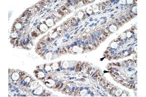 CCL18 antibody was used for immunohistochemistry at a concentration of 4-8 ug/ml to stain Epithelial cells of intestinal villus (arrows) in Human Intestine. (CCL18 antibody  (Middle Region))