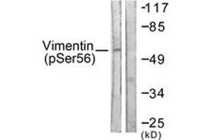 Western blot analysis of extracts from A549 cells treated with Nocodazole 1ug/ml 16h, using Vimentin (Phospho-Ser56) Antibody. (Vimentin antibody  (pSer56))