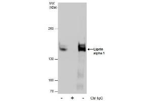 IP Image Immunoprecipitation of Liprin alpha 1 protein from A431 whole cell extracts using 5 μg of Liprin alpha 1 antibody [N1N2], N-term, Western blot analysis was performed using Liprin alpha 1 antibody [N1N2], N-term, EasyBlot anti-Rabbit IgG  was used as a secondary reagent. (PPFIA1 antibody  (N-Term))