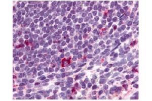 Immunohistochemical staining of spleen lymphocytes using antibody ABIN122022 (CCR2 antibody)