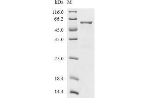 Peripherin (PRPH) (AA 1-470), (full length) protein