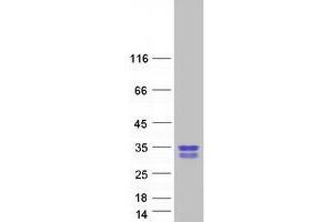 Validation with Western Blot (GAR1 Protein (Transcript Variant 2) (Myc-DYKDDDDK Tag))