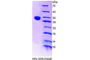 SDS-PAGE (SDS) image for Chitotriosidase (CHIT1) (AA 210-464) protein (His tag) (ABIN6237252)