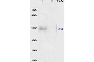 Lane 1: human colon carcinoma lysates Lane 2: mouse embryo lysates probed with Anti AVPR2 Polyclonal Antibody, Unconjugated (ABIN1386214) at 1:200 in 4 °C. (GDF9 antibody  (AA 301-400))