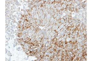 IHC-P Image Immunohistochemical analysis of paraffin-embedded Hep3B xenograft, using RRAS, antibody at 1:100 dilution. (R-Ras antibody  (Center))