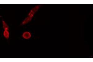 ABIN6274694 staining NIH-3T3 cells by IF/ICC. (Mre11 antibody  (C-Term))