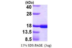 SDS-PAGE (SDS) image for CD40 Ligand (CD40LG) (AA 113-261) protein (His tag) (ABIN666635) (CD40 Ligand Protein (CD40LG) (AA 113-261) (His tag))