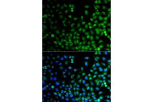Immunofluorescence analysis of A549 cell using LHX6 antibody. (LHX6 antibody)