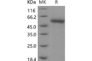 Western Blotting (WB) image for beta-Site APP-Cleaving Enzyme 2 (BACE2) (Active) protein (His tag) (ABIN7194384) (BACE2 Protein (His tag))