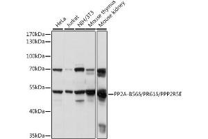 Western blot analysis of extracts of various cell lines, using PP2A-B56δ/PR61δ/PPP2R5E antibody (ABIN7269691) at 1:1000 dilution. (PPP2R5E antibody  (AA 398-467))