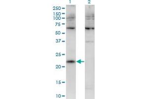 CMTM4 antibody  (AA 173-234)