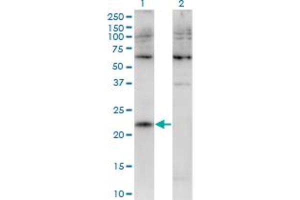 CMTM4 antibody  (AA 173-234)