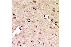 Immunohistochemical analysis of ALB staining in human brain formalin fixed paraffin embedded tissue section. (Albumin antibody  (C-Term))