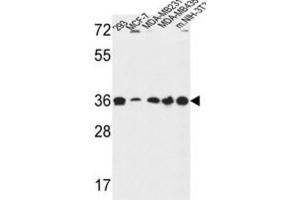 Western Blotting (WB) image for anti-Torsin Family 1, Member B (Torsin B) (TOR1B) antibody (ABIN3002128) (TOR1B antibody)