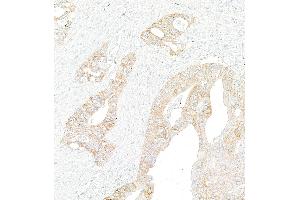Immunohistochemistry (IHC) image for anti-Met Proto-Oncogene (MET) (C-Term) antibody (ABIN7795683)