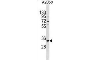 Western Blotting (WB) image for anti-TGFB-Induced Factor Homeobox 2-Like, X-Linked (TGIF2LX) antibody (ABIN3000268)