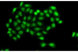 Immunofluorescence analysis of A549 cells using PHF11 Polyclonal Antibody (PHF11 antibody)