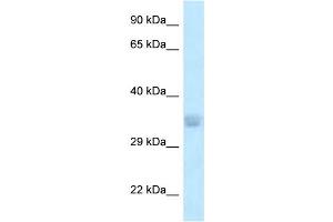WB Suggested Anti-ACOT8 Antibody Titration: 1. (ACOT8 antibody  (N-Term))