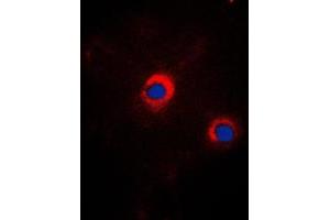 Immunofluorescent analysis of GRP94 staining in NIH3T3 cells. (GRP94 antibody  (C-Term))
